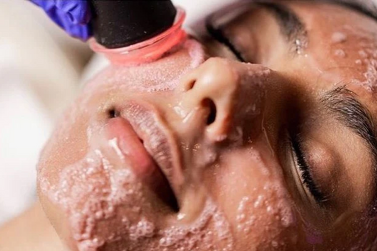 Discover Radiant Skin at Tone and Tonic: OxyGeneo Facial Treatment in Newcastle